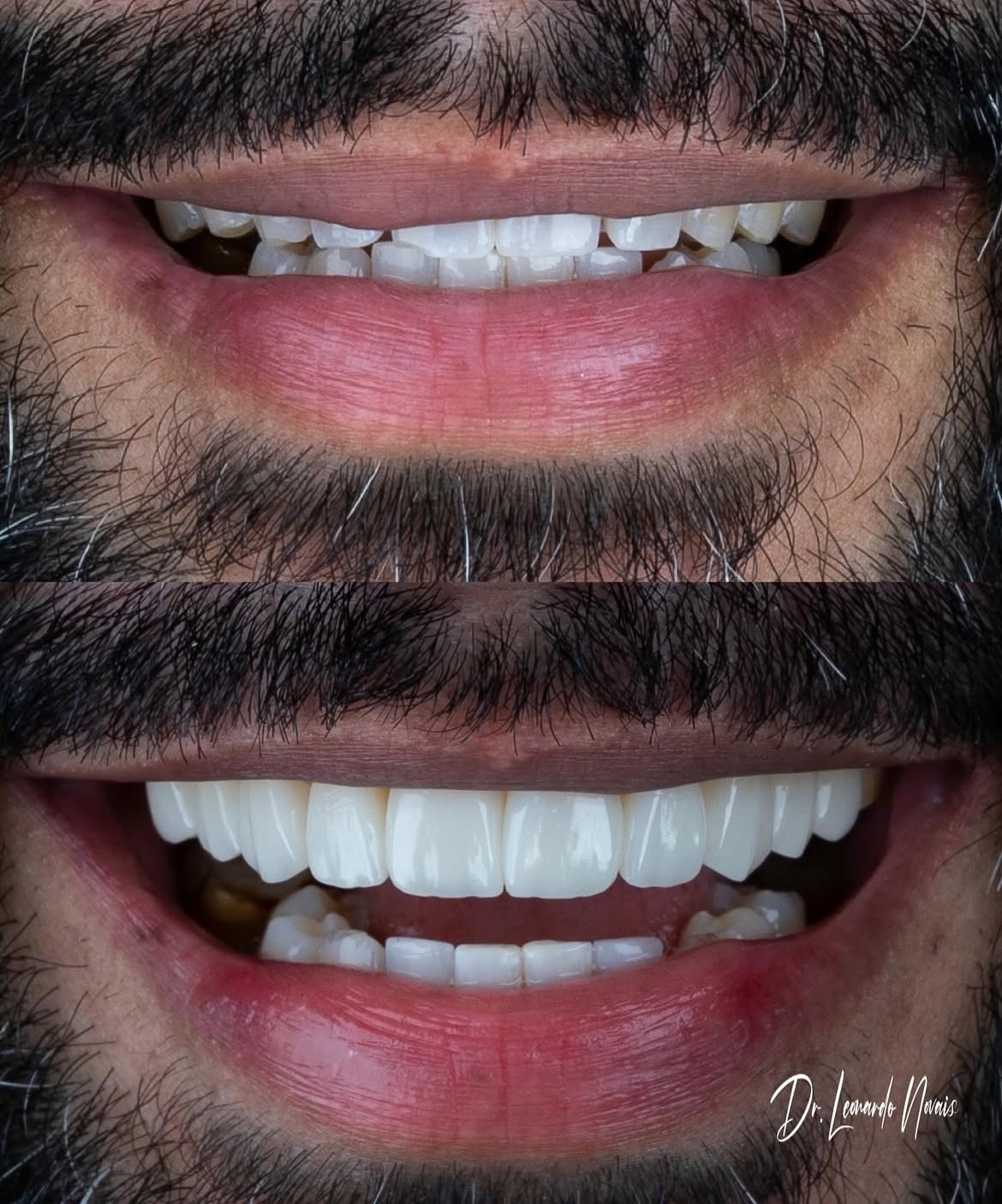Antes e depois — caso 4